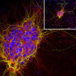 Immunofluorescent analysis of cortical neuron-glial cell culture from E20 rat stained with mouse mAb to doublecortin, MCA-3E1, dilution 1:1,000 in red, and costained with chicken pAb to microtubule associated protein 2 (MAP2), <a href="http://encorbio.com/products/cpca-map2/"  target="_blank" rel="noopener">CPCA-MAP2</a>, dilution 1:10,000 in green. The blue is DAPI staining of nuclear DNA. The doublecortin antibody reveals strong cytoplasmic staining in a population of small developing neurons 