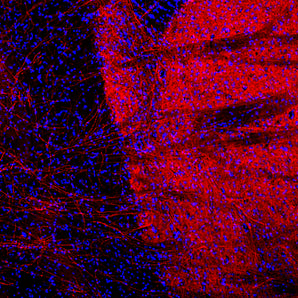 Immunofluorescent analysis of rat brain section stained with mouse mAb to tyrosine hydroxylase, MCA-4H2, dilution 1:1,000, in red. The blue is Hoechst staining of nuclear DNA. Following transcardial perfusion of rat with 4% paraformaldehyde, brain was post fixed for 24 hours, cut to 45μM, and free-floating sections were stained with the above antibodies. The MCA-4H2 antibody stains TH expressing neuronal processes, which are particularly numerous in the striatum, at the right of the image.