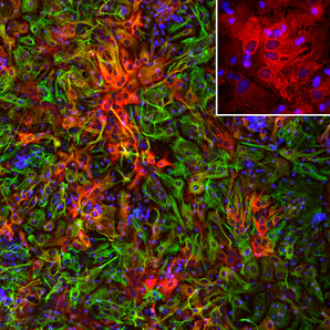 Immunofluorescent analysis of cortical neuron-glial cell culture from E20 rat stained with rabbit pAb to ALDH1L1, RPCA-ALDH1L, dilution 1:1,000 in red, and costained with chicken pAb to GFAP, <a href="http://encorbio.com/products/cpca-gfap/"  target="_blank" rel="noopener">CPCA-GFAP</a>, dilution 1:5,000 in green. The blue is DAPI staining of nuclear DNA. The ALDH1L1 antibody labels protein expressed in the cytoplasm of non-neuronal cells. The GFAP antibody stains intermediate filaments in astro