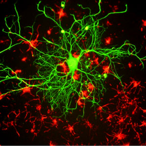 Mouse Monoclonal Antibody to Neurofilament NF-L (Nfl, NEFL) Cat# MCA-DA2