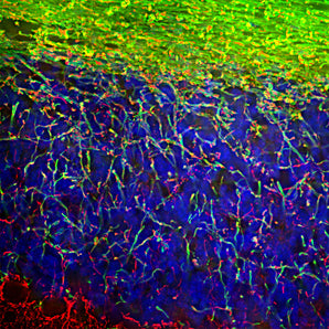 Immunofluorescent analysis of rat brain cerebellum section stained with chicken  pAb to Myelin Basic Protein (MBP), CPCA-MBP, dilution 1:5,000 in green, and costained with rabbit pAb to NF-L,  <a href="http://encorbio.com/products/rpca-nf-l/" target="_blank" rel="noopener">RPCA-NF-L</a>, dilution 1:5,000 in red. The MBP antibody stains oligodendrocytes and myelin sheathes around axons, while the NF-L antibody labels dendrites and axons of neuronal cells.