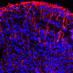 Immunofluorescent analysis of rat embryonic (E18) brain stained with chicken pAb to nestin, CPCA-Nestin, dilution 1:2,000 in red. Blue is Hoechst staining of nuclear DNA. CPCA-Nestin antibody produces strong staining of the developing radial glia and astrocytes and their processes.