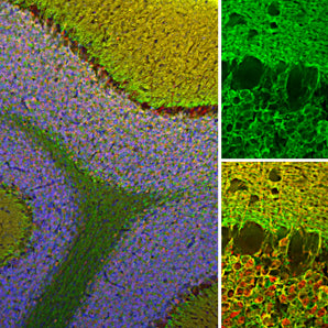 Immunofluorescent analysis of rat cerebellum section stained with rabbit pAb to VLP1, RPCA-VLP1, dilution 1:2,000 in green, and costained with mouse mAb to calretinin, <a href="http://encorbio.com/products/mca-6a9/" target="_blank" rel="noopener">MCA-6A9</a>, dilution 1:2,000 in red. The blue is Hoechst staining of nuclear DNA. Following transcardial perfusion of rat with 4% paraformaldehyde, brain was post fixed for 24 hours, cut to 45μM, and free-floating sections were stained with the above a