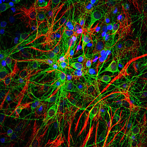 Immunofluorescent analysis of cortical neuron-glial culture from E20 rat stained with mouse mAb to MAP-τ, MCA-5B10, dilution 1:2,000 in green, and costained with chicken pAb to GFAP, <a href="http://encorbio.com/products/cpca-gfap" target="_blank" rel="noopener">CPCA-GFAP</a>, dilution 1:5,000 in red. The blue is DAPI staining of nuclear DNA. MCA-5B10 stains perikarya, dendrites and axons of neurons, while the GFAP antibody labels astrocytes.