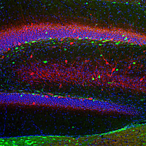 Immunofluorescent analysis of a section of rat hippocampus section stained with mouse mAb to calretinin, MCA-6A9, dilution 1:2,000 in green and costained with chicken pAb to parvalbumin, <a href="http://encorbio.com/products/cpca-pvalb" target="_blank" rel="noopener">CPCA-Pvalb</a>, dilution 1:1,000, in red. The blue is DAPI staining of nuclear DNA. Following transcardial perfusion of rat with 4% paraformaldehyde, brain was post fixed for 24 hours, cut to 45μM, and free-floating sections were st