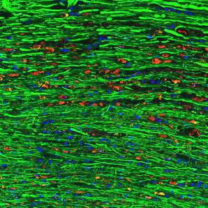 Immunofluorescence  of a section of spinal cord from a rat given a C4 contusion injury 3 days previously. The section was stained with mouse monoclonal to NF-M <a href="http://encorbio.com/product/mca-3h11" target="_blank" rel="noopener">MCA-3H11</a> in green and counterstained with RPCA-NF-L-Degen at 1:1,000 in red. The RPCA-NF-L-Degen antibody does not stain the undamaged axons which are strongly positive for the NF-M antibody. However linear arrays of swollen profiles which originated from da