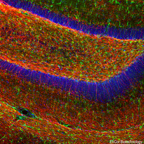 Immunofluorescent analysis of mouse hippocampus section stained with goat pAb to myelin basic protein (MBP), GPCA-MBP, dilution 1:5,000 in red, and costained with rabbit pAb to GFAP, <a href="https://encorbio.com/product/rpca-gfap/" target="_blank" rel="noopener">RPCA-GFAP</a>, dilution 1:5,000 in green. The blue is Hoechst staining of nuclear DNA. The GPCA-MBP antibody stains oligodendrocytes and myelin sheathes around axons, while the GFAP antibody reveals the network of glial cells.