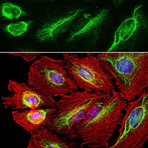 Immunofluorescent analysis of HeLa cell culture stained with chicken pAb to vimentin, CPCA-Vim, dilution 1:10,000 in green, and costained with EnCor mouse mAb to actin, <a href="http://encorbio.com/products/mca-5j11/">MCA-5J11</a>, dilution 1:500 in red. The blue is DAPI staining of nuclear DNA. The vimentin antibody stains the intermediate filament network while the actin antibody labels the submembranous cytoskeleton, stress fibers, and bundles of actin associated with cell adhesion sites.