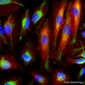 Immunofluorescent analysis of HeLa cells stained with mouse mAb to annexin A6, MCA-4G3, dilution 1:500 in red, and costained with chicken pAb to vimentin, <a href="http://encorbio.com/product/cpca-vim"  target="_blank" rel="noopener">CPCA-Vim</a>, dilution 1:2,000 in green. The blue is Hoechst staining of nuclear DNA. The annexin A6 antibody detects protein predominantly expressed in spherical cellular membrane protrusions, known as blebs, while the vimentin antibody produces strong staining of 