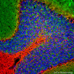 Immunofluorescent analysis of rat cerebellum section stained with rabbit pAb to NF-L RPCA-NF-L-ct, dilution 1:5,000 in red, and costained with mouse mAb to &beta;-synuclein, <a href="https://encorbio.com/product/mca-6a10/" target="_blank" rel="noopener">MCA-6A10</a>, dilution 1:500 in green. The blue is Hoechst staining of nuclear DNA. Following transcardial perfusion with 4% paraformaldehyde, the brain was post fixed for 24 hours, cut to 45&micro;M, and free-floating sections were stained with 