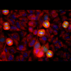 Immunofluorescent analysis of HeLa cell cultures stained with mouse mAb to aurora A kinase, MCA-1A11, in green, and costained with chicken pAb to vimentin, <a href="http://encorbio.com/products/cpca-vim/" target="_blank" rel="noopener">CPCA-Vim</a>, in red. The blue is DAPI staining of nuclear DNA. MCA-1A11 antibody labels aurora A protein expressed in spindle poles at late mitosis.