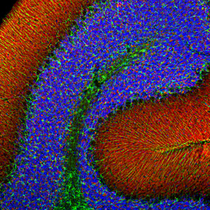 Immunofluorescent analysis of rat cerebellum section stained with mouse mAb to α-synuclein MCA-2A7, dilution 1:1,000, in red, and costained with rabbit pAb to GFAP <a href="http://encorbio.com/products/rpca-gfap" target="_blank" rel="noopener">RPCA-GFAP</a> dilution 1:5,000 in green. The blue is Hoechst staining of nuclear DNA. Following transcardial perfusion of rat with 4% paraformaldehyde, brain was post fixed for 24 hours, cut to 45μM, and free-floating sections were stained with above antib