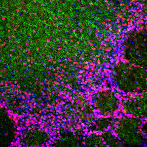 Immunofluorescent analysis of rat olfactory bulb section stained with chicken pAb to MeCP2, CPCA-MeCP2, dilution 1:2,000 in red and costained with mouse mAb to α-synuclein, <a href="http://encorbio.com/products/mca-2a7/" target="_blank" rel="noopener">MCA-2A7</a>, dilution 1:1,000, in green. The blue is DAPI staining of nuclear DNA. Following transcardial perfusion of rat with 4% paraformaldehyde, brain was post fixed for 24 hours, cut to 45μM, and free-floating sections were stained with the ab