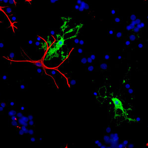 Immunofluorescent analysis of cortical neuron-glial cell culture from E20 rat stained with rabbit pAb to CNP, RPCA-CNP, dilution 1:1,000 in green, and costained with mouse mAb to GFAP, <a href="http://encorbio.com/products/mca-5c10/" target="_blank" rel="noopener">MCA-5C10</a>, dilution 1:1,000 in red. The blue is DAPI staining of nuclear DNA. The CNP antibody stains the myelin producing cells, oligodendrocytes in this part of the CNS, while the GFAP antibody stains astroglia.