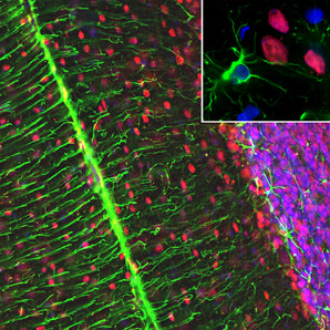 Immunofluorescent analysis of a rat cerebellum section stained with mouse mAb to MeCP2, MCA-5H12, dilution 1:1,000 in red and costained with rabbit pAb to GFAP, <a href="http://encorbio.com/product/rpca-gfap" target="_blank" rel="noopener">RPCA-GFAP</a>, dilution 1:5,000 in green. The blue is Hoechst staining of nuclear DNA. Following transcardial perfusion of rat with 4% paraformaldehyde, brain was post fixed for 1 hour, cut to 45μM, and free-floating sections were stained with the above antibo