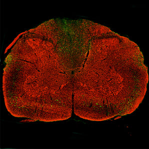 A Keyence merged image of an entire coronal section from a of rat given a contusion injury three days previously and stained for <a href="https://encrbio.com/product/rpca-nf-l-ct" target="_blank" rel="noopener">RPCA-NF-L-ct</a> in red and MCA-1D44 in green. MCA-1D44 positive profiles are particularly obvious in the dorsal columns, corticospinal tracts and rubrospinal tracts, less abundant in the lateral and ventral funuculi and least abundant but not totally absent in the spinal cord gray matter