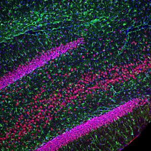 Immunofluorescent analysis of rat hippocampus section stained with mouse mAb to TDP43, MCA-3H8, dilution 1:2,000 in red, and costained with chicken pAb to GFAP, <a href="https://www.encorbio.com/products/cpca-gfap/" target="_blank" rel="noopener">CPCA-GFAP</a>, dilution 1:5,000 in green. The blue is DAPI staining of nuclear DNA. Following transcardial perfusion of rat with 4% paraformaldehyde, brain was post fixed for 24 hours, cut to 45μM, and free-floating sections were stained with above anti