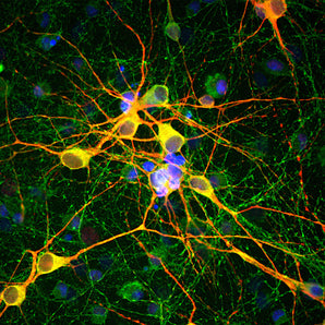 Immunofluorescent analysis of cortical neuron-glial culture from E20 rat stained with mouse mAb to MAP-τ, MCA-2E9, dilution 1:1,000 in green, and costained with chicken pAb to MAP2, <a href="http://encorbio.com/products/cpca-map2">CPCA-MAP2</a>, dilution 1:5,000 in red. The blue is DAPI staining of nuclear DNA. MCA-2E9 antibody stains perikarya, dendrites and axons of neurons, while MAP2 antibody labels only dendrites and perikarya. As a result, perikarya and dendrites appear orange-yellow, sinc