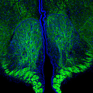 Immunohistological analysis of a rat brain coronal section of the third ventricle stained with mouse monoclonal antibody to phosphorylated NF-H, MCA-9B12, dilution 1:5,000 in green. The blue is Hoechst staining of nuclear DNA. Following transcardial perfusion with 4% paraformaldehyde, brain was post fixed for 24 hours, cut to 45μM, and free-floating sections were stained with above antibody. The MCA-9B12 antibody is a robust marker of the axons of neuronal cells.