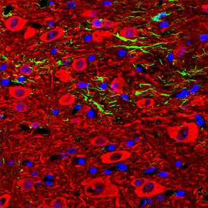 Immunofluorescent analysis of a section of adult mouse cerebellar dentate nucleus stained with chicken pAb to neuron specific enolase (NSE), CPCA-NSE, dilution 1:3,000 in red. The section was costained with rabbit pAb to GFAP, <a href="http://encorbio.com/product/rpca-gfap" target="_blank" rel="noopener">RPCA-GFAP</a>, dilution 1:5,000 in green. The blue is Hoechst staining of nuclear DNA. Following transcardial perfusion of mouse with 4% paraformaldehyde, brain was post fixed for 24 hours, cut 