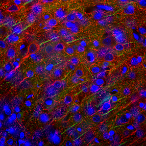 Immunofluorescent analysis of cortex section of rat brain stained with mouse mAb to ankyrin 3, MCA-2A8, dilution 1:2,000 in green and costained with rabbit pAb to NF-L, <a href="http://encorbio.com/product/rpca-nf-l"  target="_blank" rel="noopener">RPCA-NF-L</a>, dilution 1:5,000 in red. The blue is Hoechst staining of nuclear DNA. Following transcardial perfusion of rat with 4% paraformaldehyde, brain was post fixed for 24 hours, cut to 45μM, and free-floating sections were stained with above a