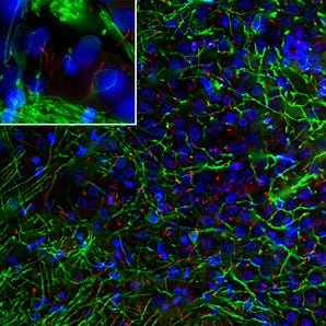 Immunofluorescence analysis of rat cortex section stained with chicken pAb to adenylate cyclase III, CPCA-ACIII, dilution 1:10,000, in red and costained with mouse mAb to the myelin and oligodendrocyte marker CNP, <a href="http://encorbio.com/product/mca-1h10" target="_blank" rel="noopener">MCA-1H10</a>, dilution 1:1,000 in green. The blue is Hoechst staining of nuclear DNA. The ACIII antibody reveals neuronal cilia while the CNP antibody stains oligodendrocytes and the myelin sheath around axon