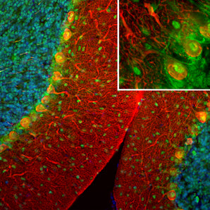 Immunofluorescent analysis of a rat brain cerebellum section stained with rabbit pAb to secretagogin, RPCA-SCGN, dilution 1:1,000, in green, and costained with mouse mAb to calbindin, <a href="http://encorbio.com/products/mca-4h7/" target="_blank" rel="noopener">MCA-4H7</a>, dilution 1:1,000 in red. The blue is DAPI staining of nuclear DNA. Following transcardial perfusion with 4% paraformaldehyde, brain was post fixed for 24 hours, cut to 45μM, and free-floating sections were stained with the a