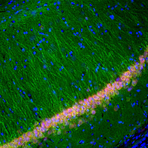 Immunofluorescent analysis of rat hippocampal section stained with mouse mAb to UCHL1, MCA-BH7, dilution 1:5,000 in green and costained with rabbit pAb to FOX/NeuN, <a href="http://encorbio.com/products/rpca-fox3" target="_blank" rel="noopener">RPCA-FOX3</a>, dilution 1:2,000, in red. The blue is Hoechst staining of nuclear DNA. Following transcardial perfusion of rat with 4% paraformaldehyde, brain was post fixed for 24 hours, cut to 45 μM, and free-floating sections were stained with above ant