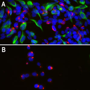 Immunofluorescent analysis of human neuroblastoma cell line SH-SY5Y (A) and rat <a href="https://en.wikipedia.org/wiki/Pheochromocytoma">pheochromocytoma</a> cell line PC12 (B), stained with mouse mAb to peripherin, MCA-8G2, dilution 1:500, in red, and costained with chicken pAb to vimentin, <a href="http://encorbio.com/products/cpca-vim/">CPCA-Vim</a>, dilution 1:10,000, in green. The blue is DAPI staining of nuclear DNA. Peripherin, one of the Class III family of intermediate filament (IF) sub