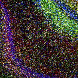 Immunofluorescent analysis of rat hippocampal section stained with mouse mAb to myelin basic protein (MBP), MCA-7G7, dilution 1:5,000 in green, and costained with rabbit pAb to neurofilament NF-H,  <a href="http://encorbio.com/products/rpca-nf-h/" target="_blank" rel="noopener">RPCA-NF-H</a>, dilution 1:2,000, in red. The MBP antibody stains oligodendrocyte cell bodies and the myelin sheathes around axons, while the NF-H antibody labels the axons themselves.