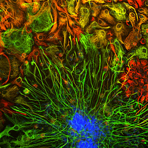 Immunofluorescent analysis of cortical neuron-glial cell cultures from E20 rat stained with mouse mAb to vimentin, MCA-2D1, dilution 1:2,000 in red, and costained with chicken pAb to glial fibrillary acidic protein (GFAP), <a href="http://encorbio.com/products/cpca-gfap" target="_blank" rel="noopener">CPCA-GFAP</a>, dilution 1:5,000, in green. The blue is DAPI staining of nuclear DNA. Fibroblastic and other developing cells express only vimentin and appear red. Astrocytes that express GFAP only 