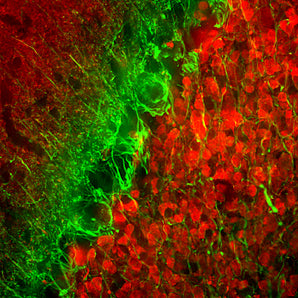 Immunofluorescent analysis of rat cerebellum section stained with mouse mAb to α-internexin, MCA-1D2, dilution 1:5,000 in green, and costained with chicken pAb to calretinin, <a href="http://encorbio.com/products/cpca-calret/" target="_blank" rel="noopener">CPCA-Calret</a>, 1:2,000 in red. Following transcardial perfusion of rat with 4% paraformaldehyde, brain was post fixed for 24 hours, cut to 45μM, and free-floating sections were stained with the above antibodies. The α-internexin antibody se