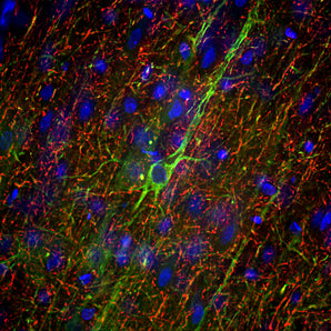 Immunofluorescence analysis of adult rat frontal cortex section stained with mouse mAb to neurofilament NF-M, MCA-3H11, dilution 1:5,000 in green, and costained with chicken pAb to neurofilament NF-H, <a href="http://encorbio.com/products/cpca-nf-h"  target="_blank" rel="noopener">CPCA-NF-H</a>, dilution 1:5,000 in red. Following transcardial perfusion of rat with 4% paraformaldehyde, brain was post fixed for 24 hours, cut to 45μM, and free-floating sections were stained with above antibodies. M