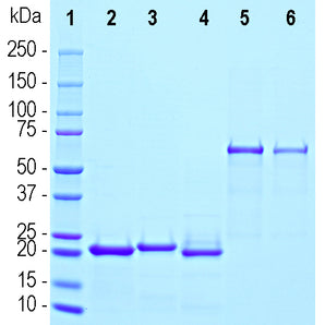 Coomassie Brilliant Blue staining of SDS-PAGE gel of recombinant human synuclein proteins. Lane 1 shows protein standards of apparent molecular weight as indicated in kDa. Other lanes show ~2&micro;g of [2] α-synuclein, [3] β-synuclein, and [4] &gamma;-synuclein. Lanes [5] and [6] show 2.0 and 1.0μg of BSA respectively.