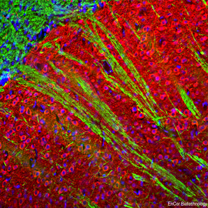 Immunofluorescent analysis of rat brain striatum stained with rabbit pAb to microtubule associated protein 2A and 2B isotypes (MAP2A/B), RPCA-MAP2A/B, dilution 1:10,000 in red, and costained with chicken pAb to myelin basic protein (MBP), <a href="http://encorbio.com/product/cpca-mbp"  target="_blank" rel="noopener">CPCA-MBP</a>, dilution 1:5,000 in green. The blue is Hoechst staining of nuclear DNA. The MAP2A/B antibody stains dendrites and perikarya of neurons, while the MBP antibody labels ol