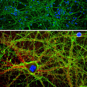 Immunofluorescent analysis of cortical neuron-glial cell culture from E20 rat stained with chicken pAb to GAP43, CPCA-GAP43, dilution 1:2,000 in green, and costained with rabbit pAb to α-II spectrin,  <a href="http://encorbio.com/products/rpca-aii-spec/" target="_blank" rel="noopener">RPCA-aII-Spec</a>, dilution 1:1,000 in red. The blue is DAPI staining of nuclear DNA. GAP43 antibody labels protein expressed in the axonal membrane and synapses of neuronal cells, while the spectrin antibody stain