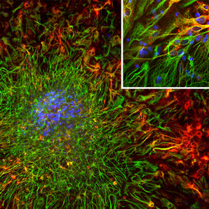 Immunofluorescent analysis of cortical neuron-glial cell culture from E20 rat stained with mouse mAb to aldehyde dehydrogenase 1-L1 (ALDH1L1), MCA-2E7, dilution 1:1,000 in red, and costained with chicken pAb to GFAP, <a href="http://encorbio.com/cpca-gfap" target="_blank" rel="noopener">CPCA-GFAP</a>, dilution 1:5,000 in green. The blue is Hoechst staining of nuclear DNA. The MCA-2E7 antibody produces cytoplasmic staining of glial cells, while the CPCA-GFAP antibody labels the intermediate filam