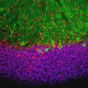 Immunofluorescent analysis of rat cerebellum section costained with rabbit pAb to MeCP2, RPCA-MeCP2, dilution 1:5,000, in red, and chicken pAb to calbindin, <a href="http://encorbio.com/products/CPCA-Calb" target="_blank" rel="noopener">CPCA-Calb</a>, dilution 1:2,000, in green. Blue is DAPI staining of nuclear DNA. Following transcardial perfusion with 4% paraformaldehyde, brain was post fixed for 24 hours, cut to 45μM, and free-floating sections were stained with above antibodies. The MeCP2 an