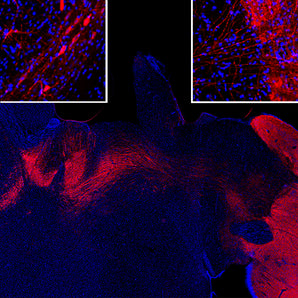 Immunofluorescent analysis of rat brain sections stained with goat pAb to tyrosine hydroxylase, GPCA-TH, dilution 1:2,000, in red. The blue is Hoechst staining of nuclear DNA. Following transcardial perfusion of rat with 4% paraformaldehyde, brain was post fixed for 24 hours, cut to 45μM, and free-floating sections were stained with above antibodies. GPCA-TH antibody strongly and specifically stains the striatal TH-expressing interneurons. Inset top left shows neuronal cell bodies and top right 