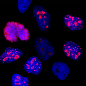 Immunofluorescent analysis of HeLa cells stained with mouse mAb to Ki67, MCA-6G3, dilution 1:2,000 (red). The blue is DAPI staining of nuclear DNA. The MCA-6G3 antibody stains Ki67 protein predominantly expressed in the nucleoli of rapidly dividing cells, while nearby quiescent cells express little or no Ki67. The Ki67 protein also coats the surface of condensed chromosomes as seen at the middle left of the image.