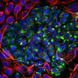 Immunofluorescent analysis of mixed fibroblast and PC12 pheochromocytoma cell culture stained with chicken pAb to peripherin, CPCA-Peri, dilution 1:5,000 in green, and costained with rabbit pAb to vimentin, <a href="http://encorbio.com/RPCA-Vim" target="_blank" rel="noopener">RPCA-Vim</a>, dilution 1:2,000, in red. The blue is DAPI staining of nuclear DNA. CPCA-Peri antibody reveals cytoplasmic filamentous staining in the small PC12 cells, while vimentin antibody stains intermediate filaments in