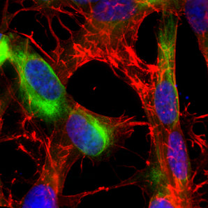 Immunofluorescent analysis of SH-SY5Y cell culture stained with rabbit pAb to nestin, RPCA-Nestin, dilution 1:3,000 in green, and costained with mouse mAb to actin, <a href="http://encorbio.com/product/mca-5j11"  target="_blank" rel="noopener">MCA-5J11</a>, dilution 1:500 in red. Blue is Hoechst staining of nuclear DNA. RPCA-Nestin antibody produces strong staining in the cytoplasm in clearly filamentous fashion, while actin antibody stains the submembranous actin-rich cytoskeleton, stress fiber