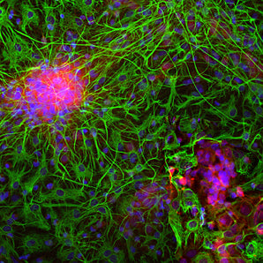 Immunofluorescent analysis of mixed cortical neuron-glial cell culture from E20 rat stained with rabbit pAb to neuron specific enolase (NSE), RPCA-NSE, dilution 1:500 in red, and costained with chicken pAb to GFAP, <a href="http://encorbio.com/products/cpca-gfap/" target="_blank" rel="noopener">CPCA-GFAP</a>, dilution 1:5,000 in green. The blue is Hoechst staining of nuclear DNA. the NSE antibody labels protein expressed in neuronal cells, while the GFAP antibody stains intermediate filaments in