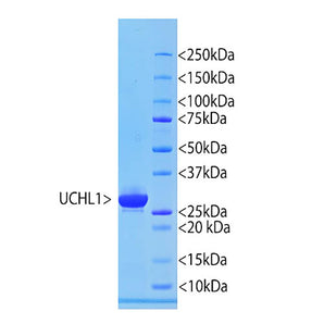 A codon optimized cDNA encoding full length human UCHL1 was generated and inserted into the pET30a(+) expression vector. The vector adds an N-terminal His-tag and some other vector derived sequence to the human sequence which increases the molecular weight by about 5kDa. The construct was expressed by standard methods in <em>E. coli</em> and purified using a Nickel column in 6M urea. The protein is supplied in 6M urea in phosphate buffer. The lane on the left shows the pure protein and the lane 