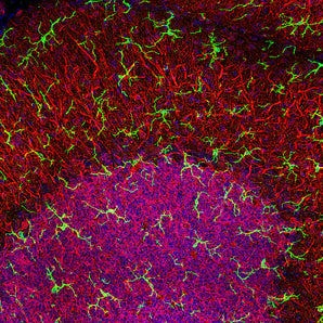 High magnification stacked confocal image of rat cerebellar molecular layer at top and granular layer below, stained with RPCA-IBA1, dilution 1:1,000, in green. Microglia are very small cells with fine processes spreading in three dimensions and so are best visualized in a confocal Z stack. Red shows the processes of Purkinje cells and the perikarya of granule cells revealed with <a href="http://encorbio.com/products/cpca-map2/" target="_blank" rel="noopener">CPCA-MAP2</a>, an antibody to MAP2, 